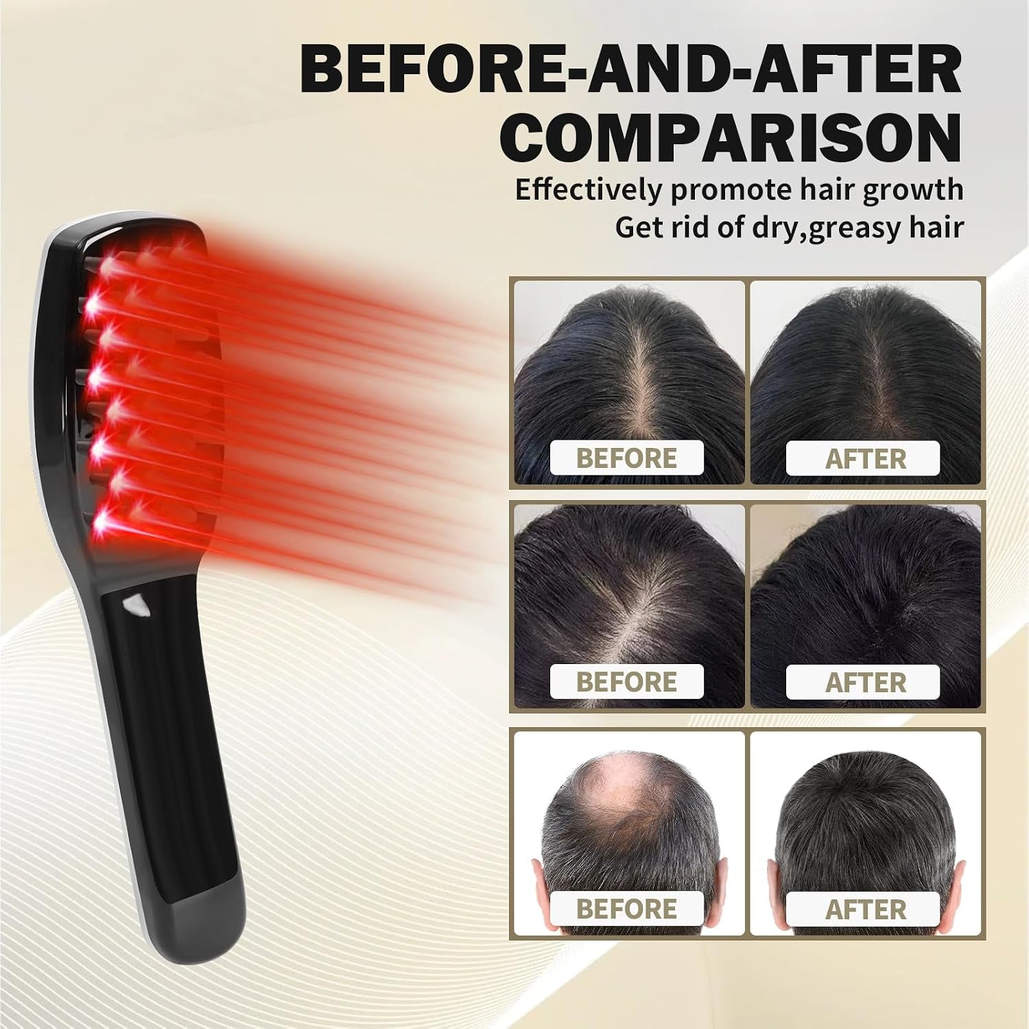 Scalp Massager, Electric Scalp Massage Brush, Hair Massage Brush, Electrichead Scratcher, Masssage Comb with Soft Rubber.
