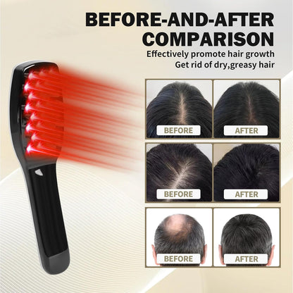 Scalp Massager, Electric Scalp Massage Brush, Hair Massage Brush, Electrichead Scratcher, Masssage Comb with Soft Rubber.